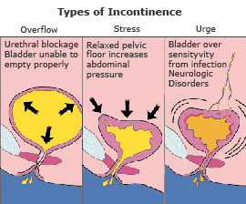 Phalloplasty, Penis Enlargement Surgery Cost in Mumbai Chennai Delhi Kolkata Hyderabad Bangalore Pune Ahmedabad India جراحة رأب القضيب في الهند